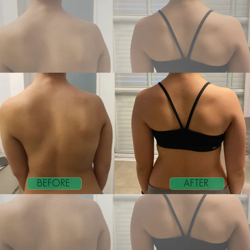 KENORA⢠Instant Posture Corrector