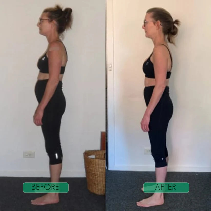 KENORA⢠Instant Posture Corrector