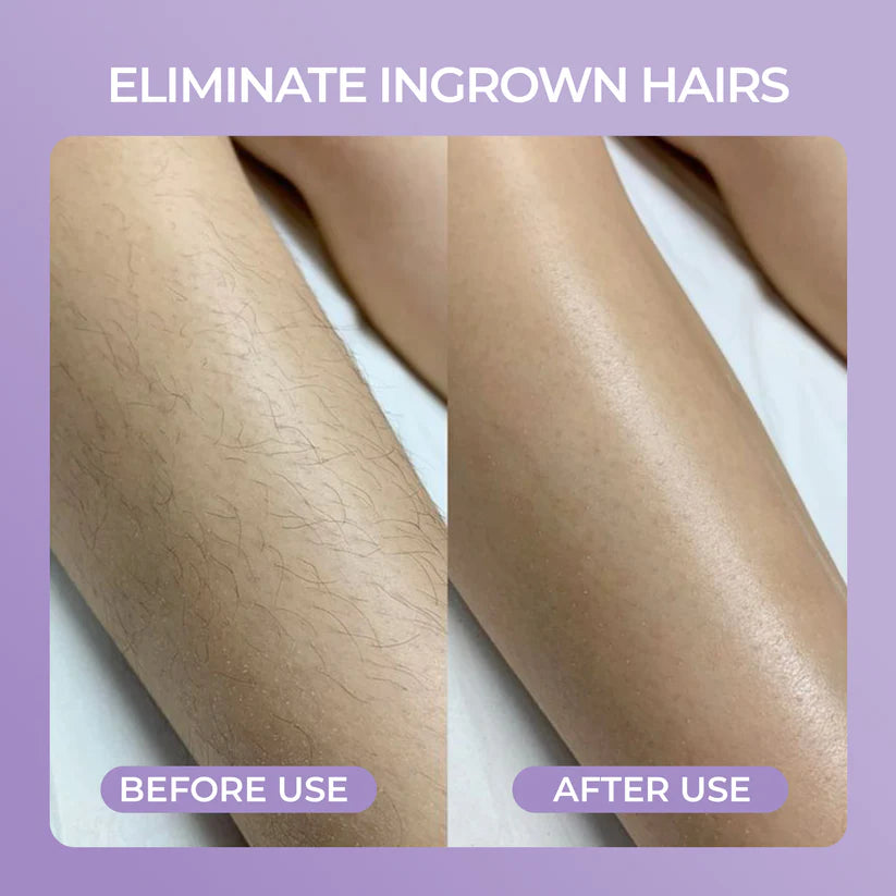 Kenora™ Crystal Hair Eraser