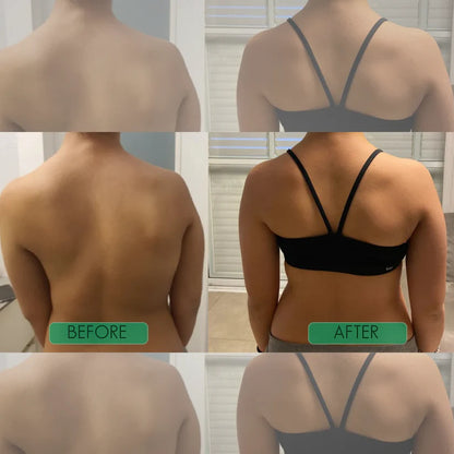 KENORA™ Instant Posture Corrector